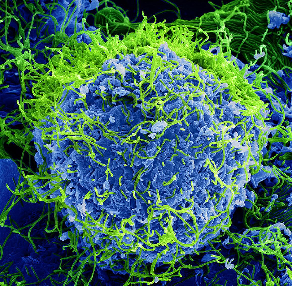 Clinical Trial of Investigational Ebola Treatments Begins in the Democratic Republic of the Congo