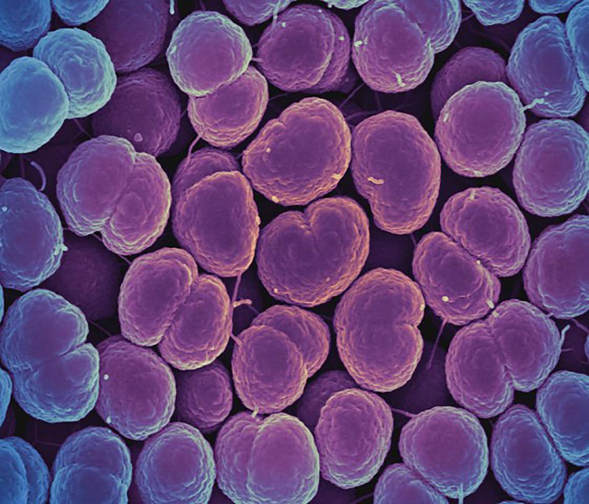 Colorized scanning electron micrograph of Gonorrhea bacteria