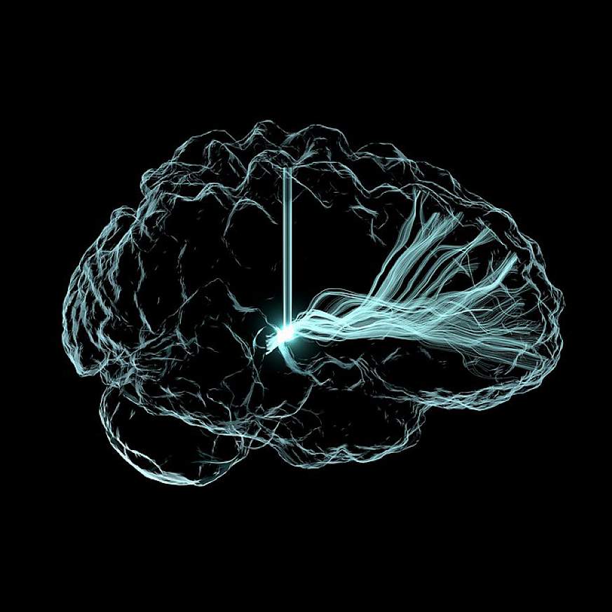 Outpatient Psychiatry