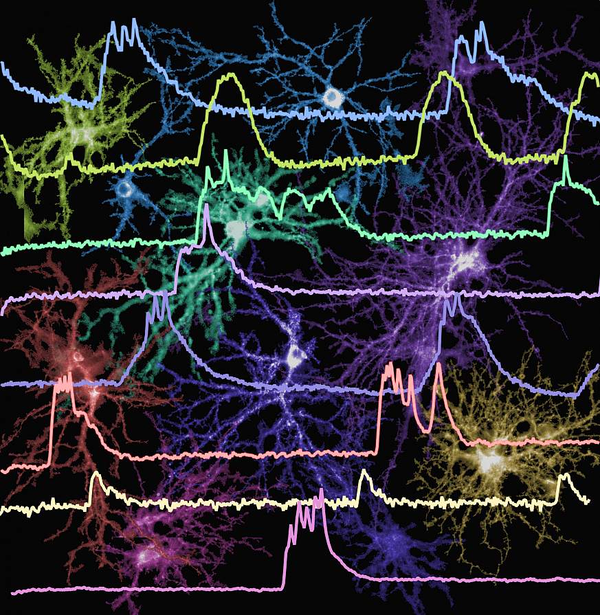 Image of neuron firing patterns