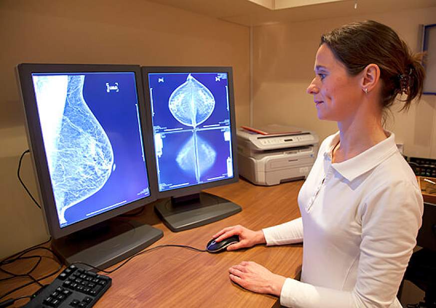 A radiology technician reviews a mammogram.