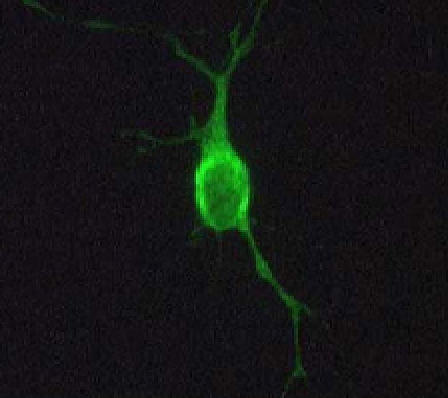 Image of a rat neuron. 