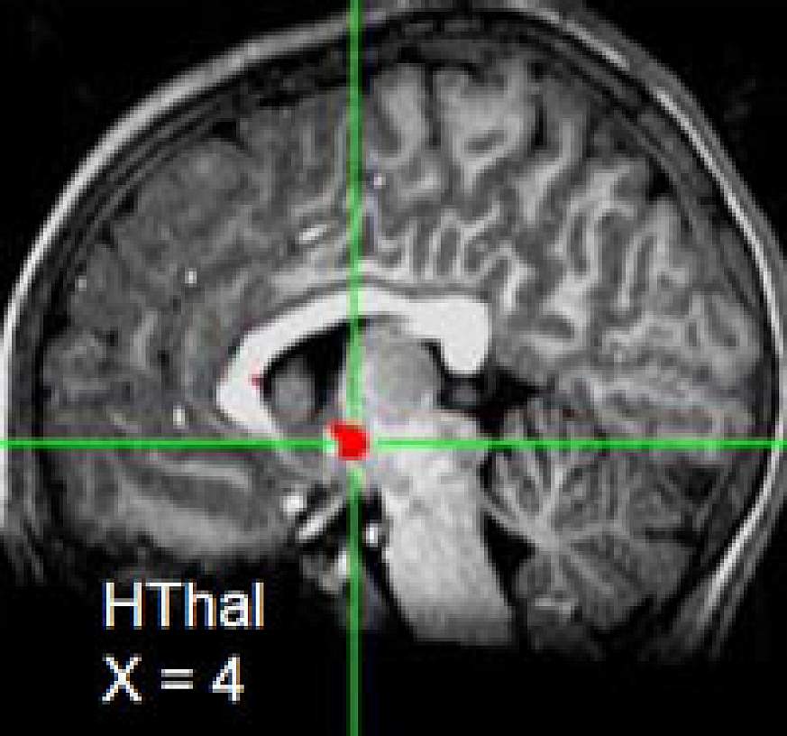 Brain areas activated in approach circuit. 