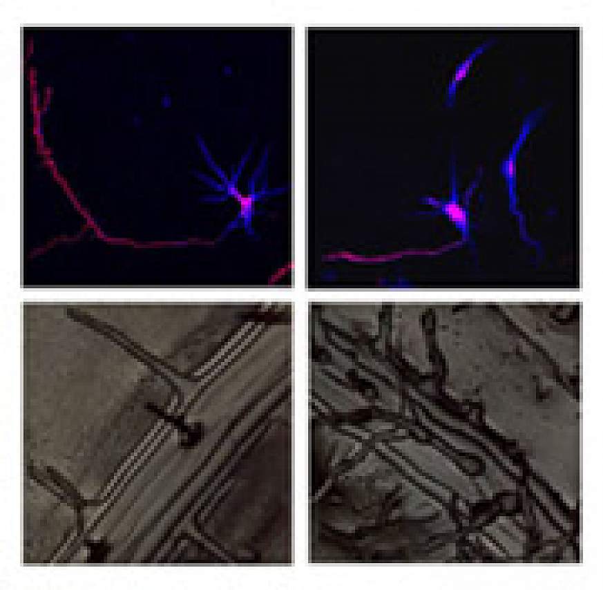 Rat cortical neurons and plant roots.