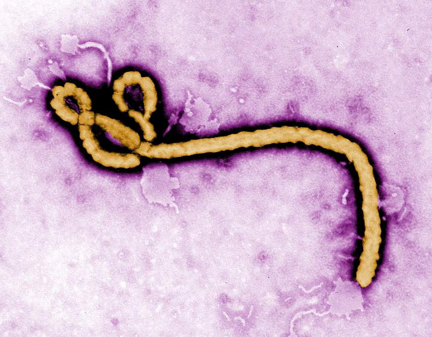 Transmission electron micrograph of Ebola virus