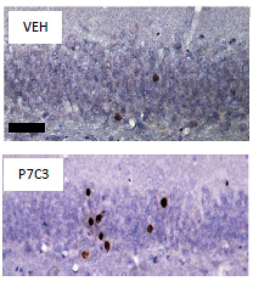 Image of Rat Dentate Gyrus: Newborn Neurons