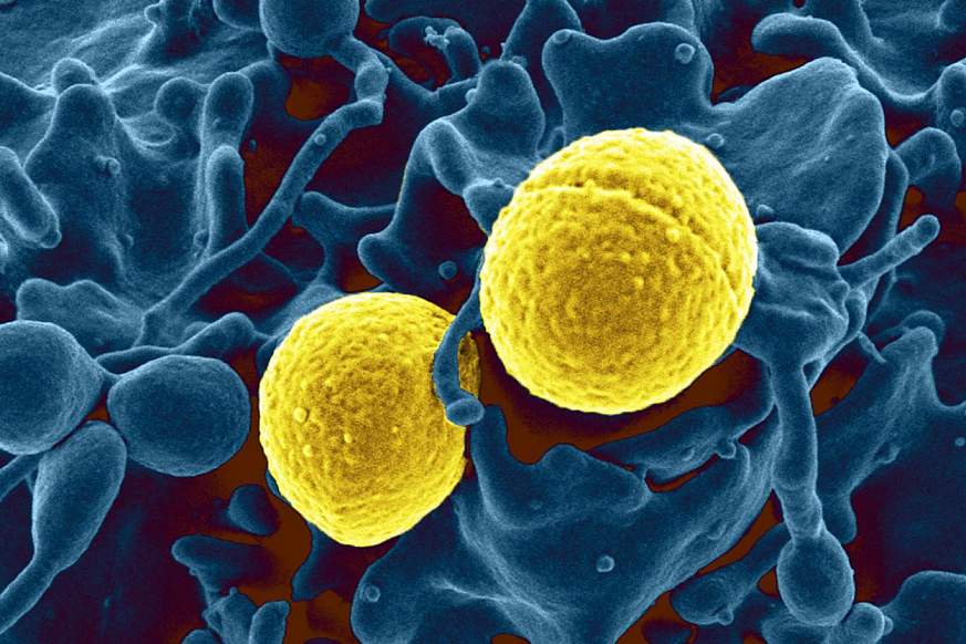 SA300 strain of Staphylococcus aureus bacteria, shown outside a white blood cell