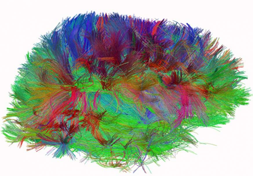 Diffusion spectrum imaging of human brain