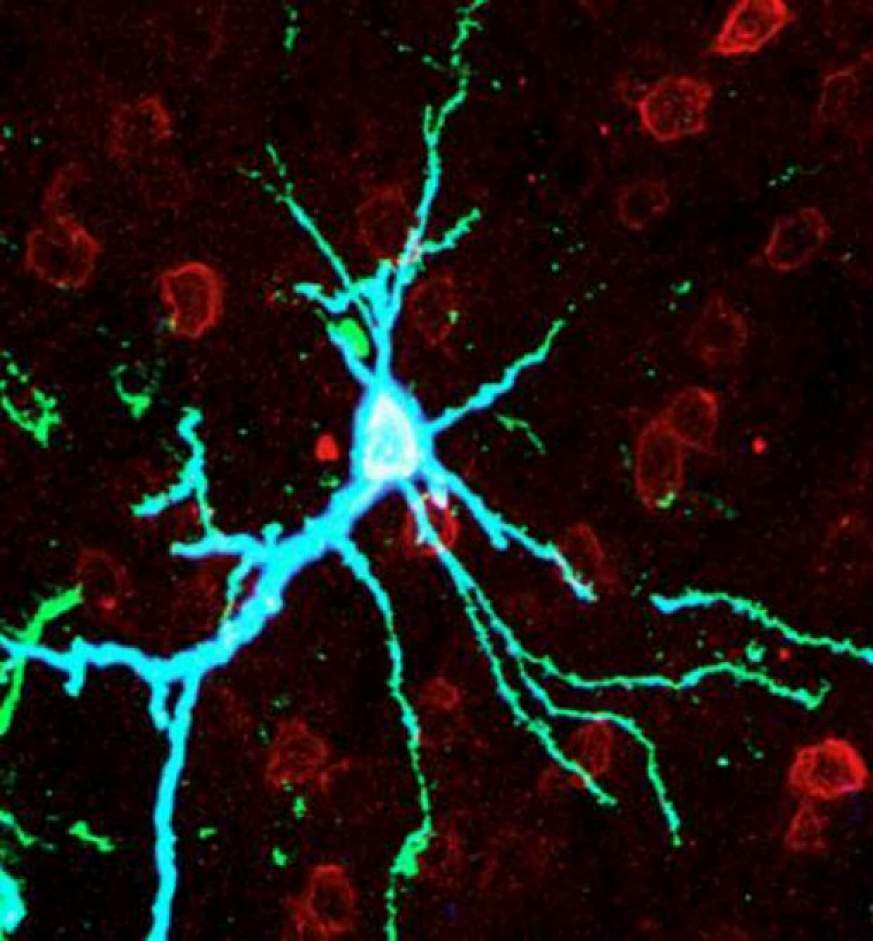 Neuron over-expressing PKMzeta