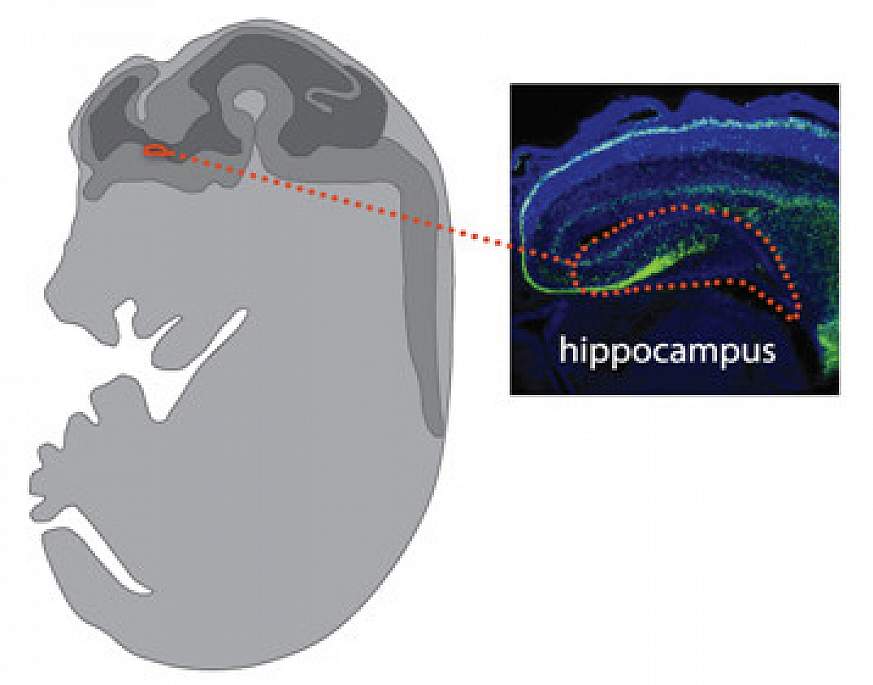 Interneuron cells highlighted in the brain