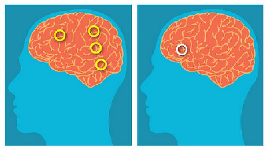 Illustrations of brain activity during rhyming task.