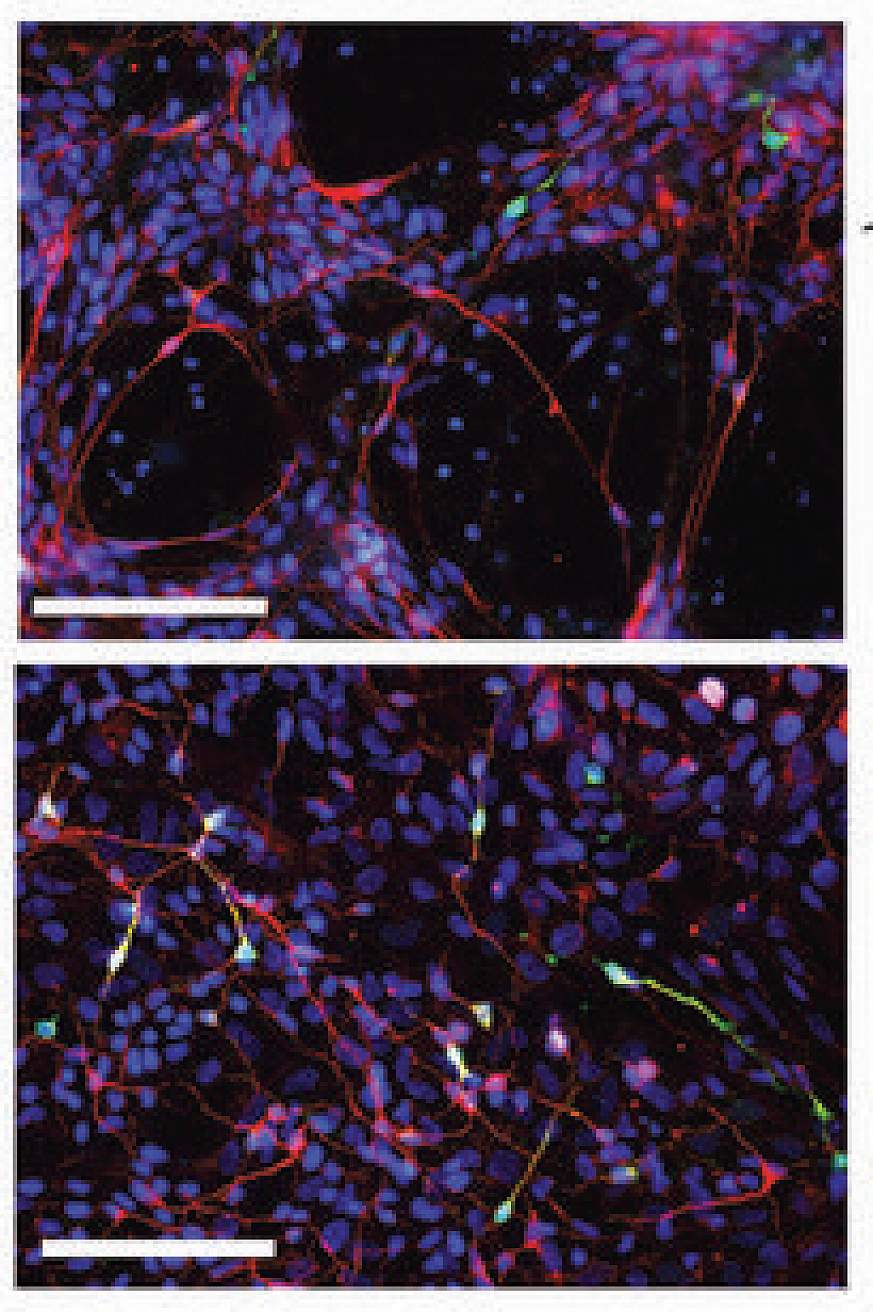 Image of  catecholamine-producing neurons.