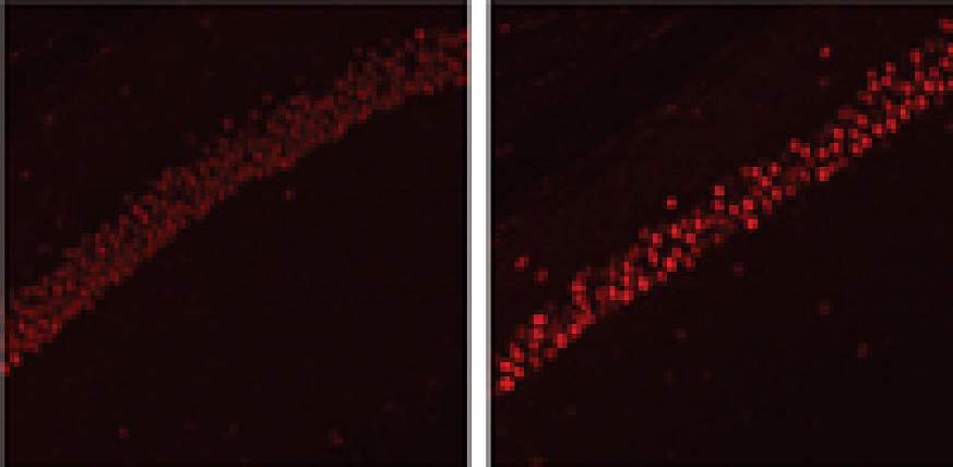 Mouse model of Alzheimer's disease elevated protein levels in the hippocampus.