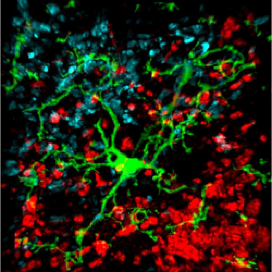 Leaking blood vessel in mouse brain