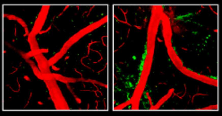 ApoE4 weakens the blood-brain barrier in mice.