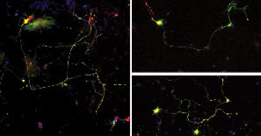 Photo showing effects of mutant profilin on axon growth.