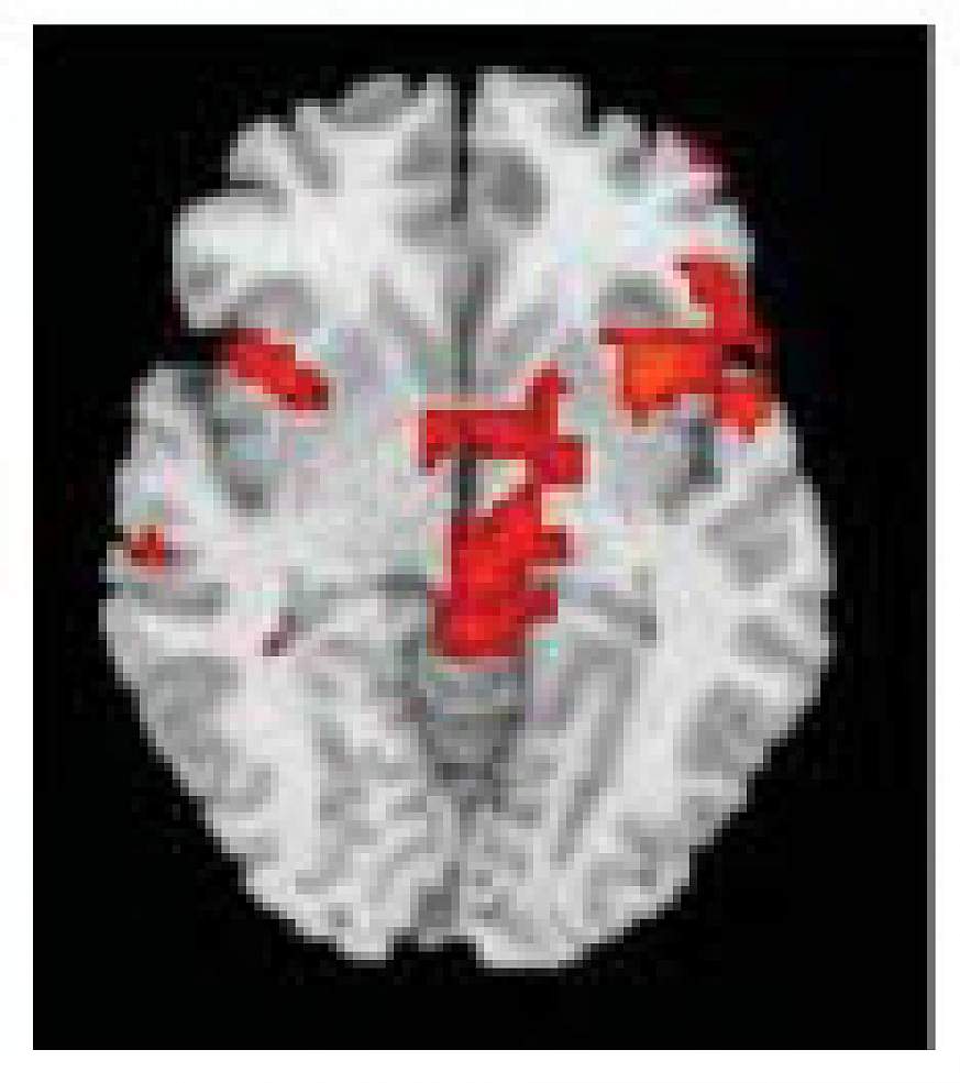 hubs of salience network