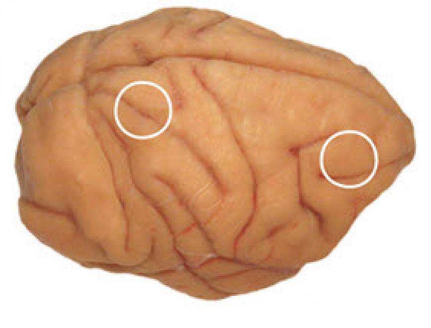 Hubs of brain working memory circuit