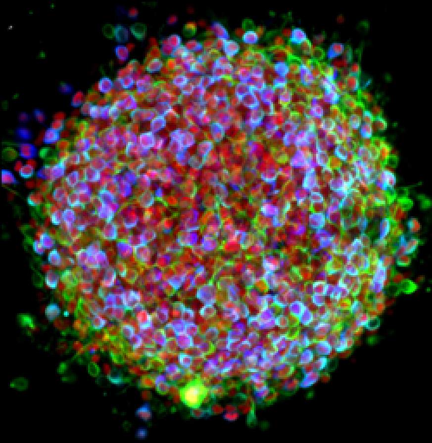 A cluster of iPS cells  differentiating into neurons. 