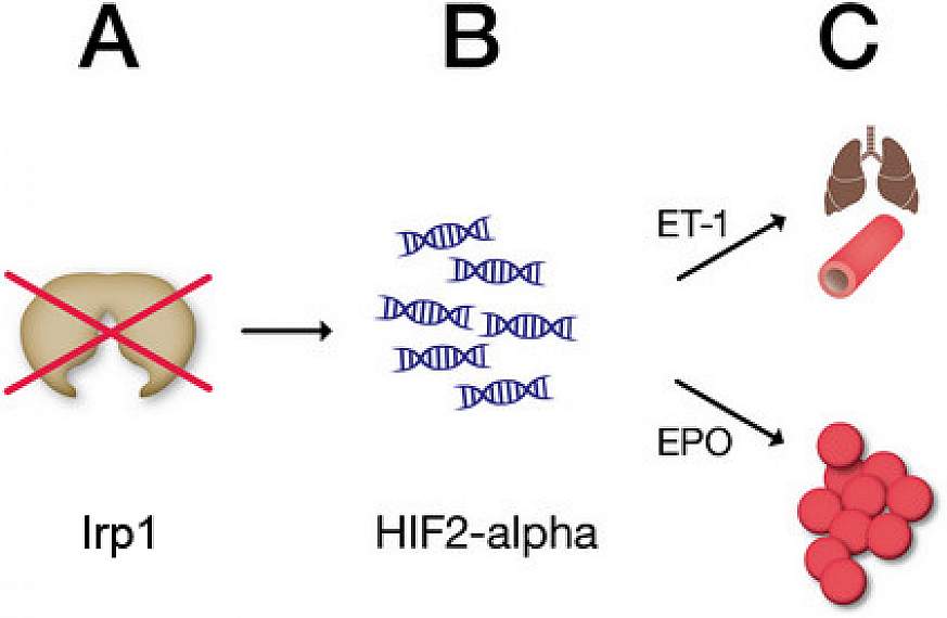 Graphic illustrating effect of loss of iron protein