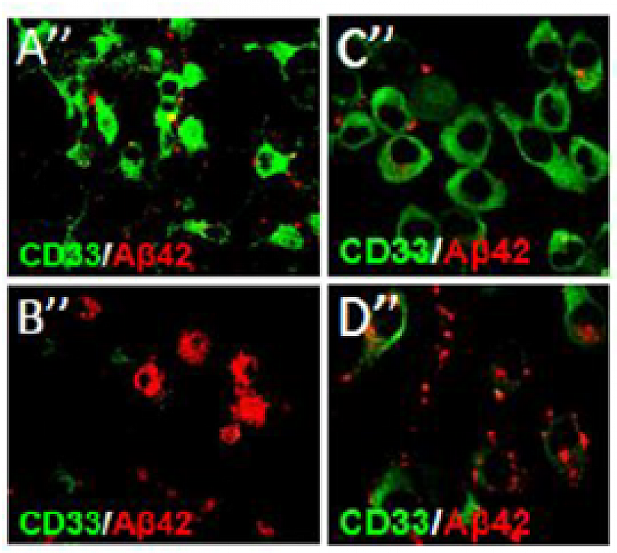 Images of a regulator protein active in a mouse brain.