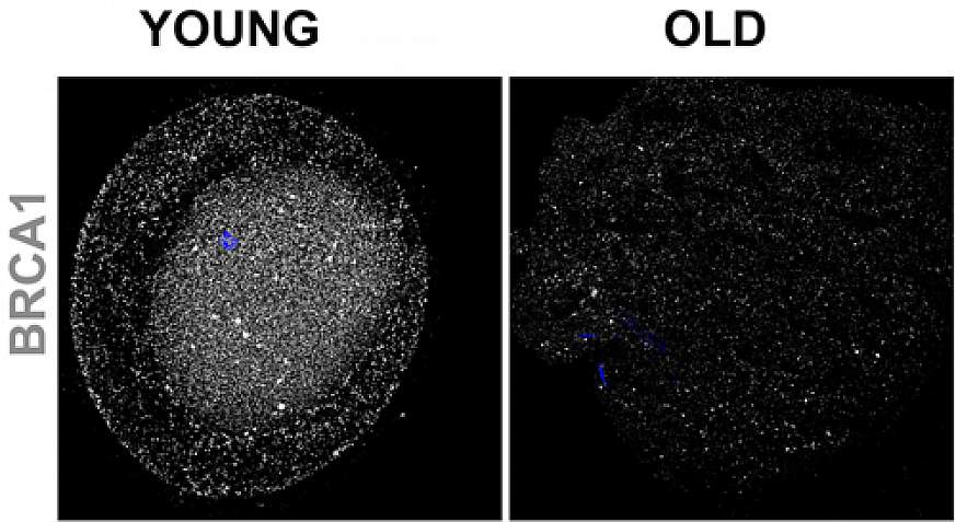 Image of oocytes from younger and older women.