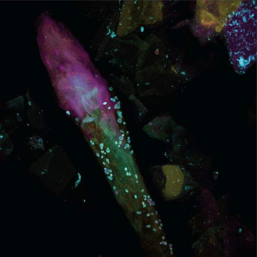 Magnified image of fungi on a hair follicle.
