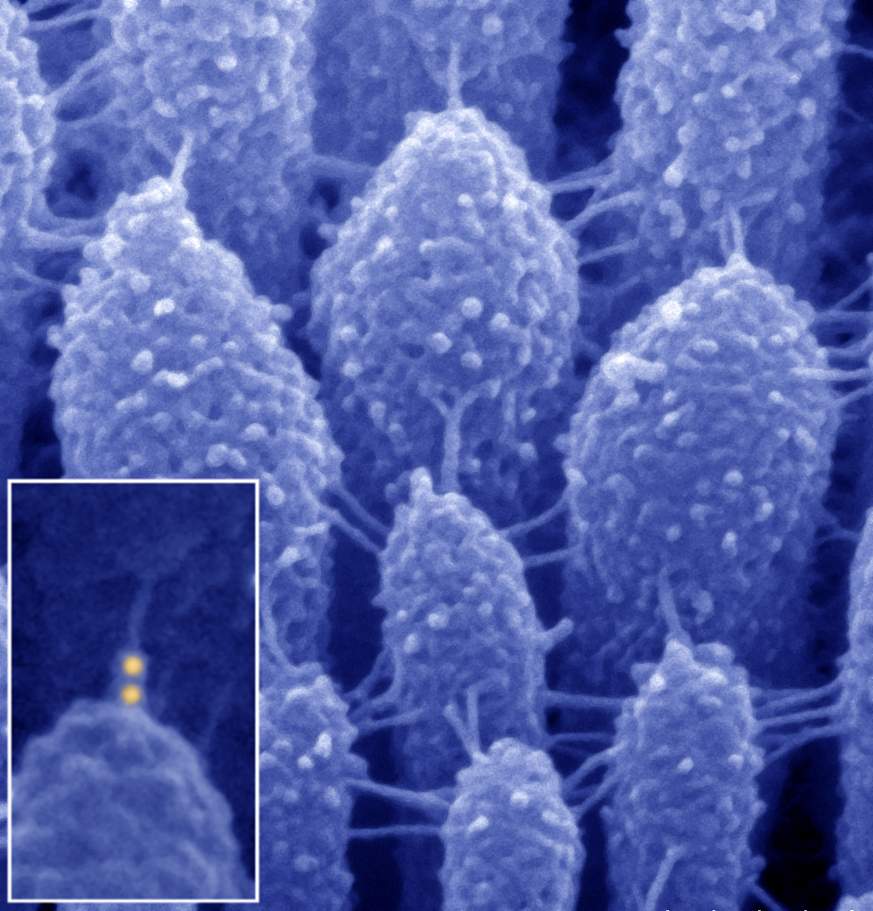 Electron microscope image of ear tip links