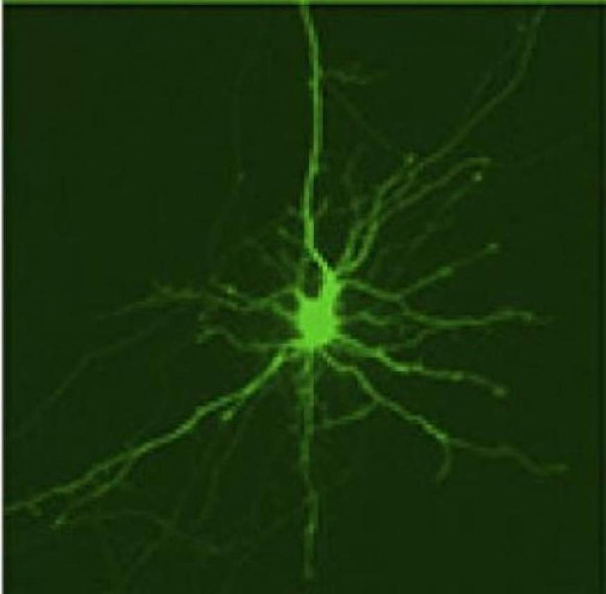 striatal neuron