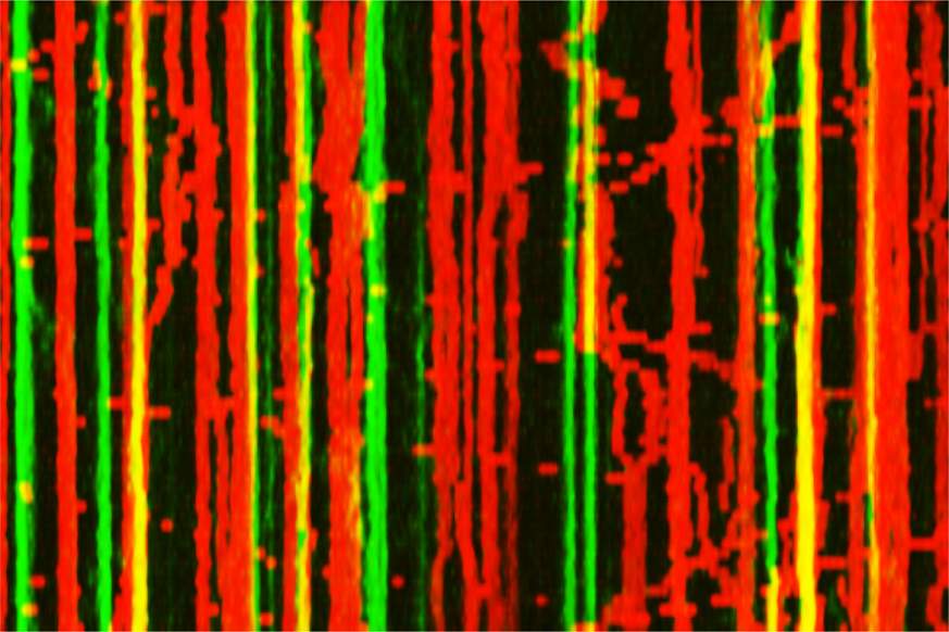 kymograph showing red and green echoing lines.