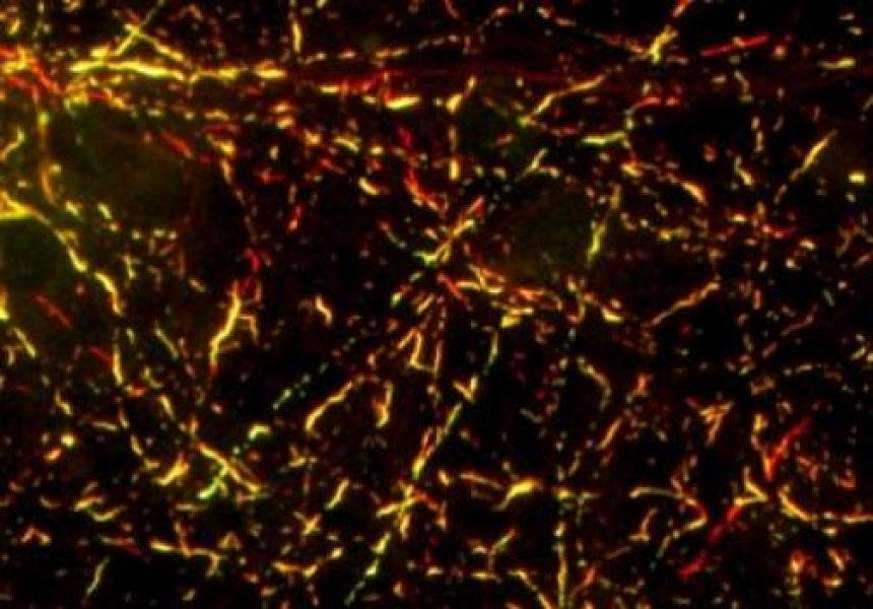 Effect of strain B on mouse cells