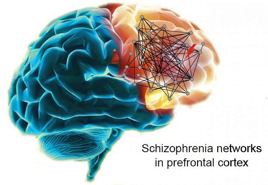 Illustration of schizophrenia networks in the human brain