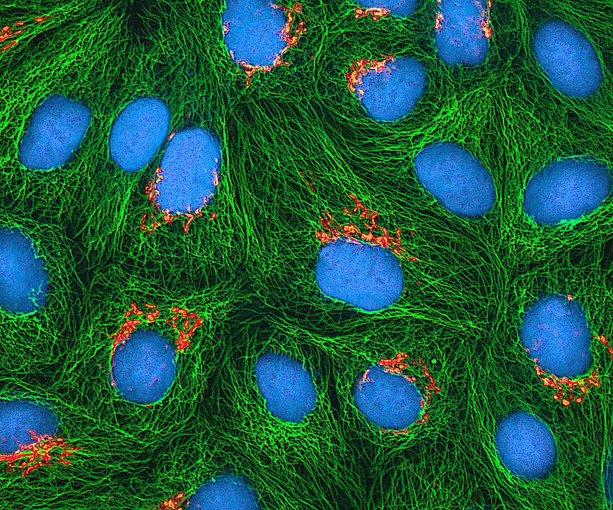Image showing cells stained to illustrate the Golgi apparatus, the microtubules and DNA.