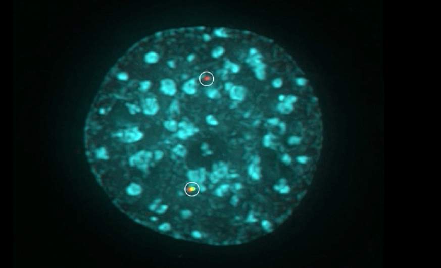 A chromosome translocation visualized in 3D.