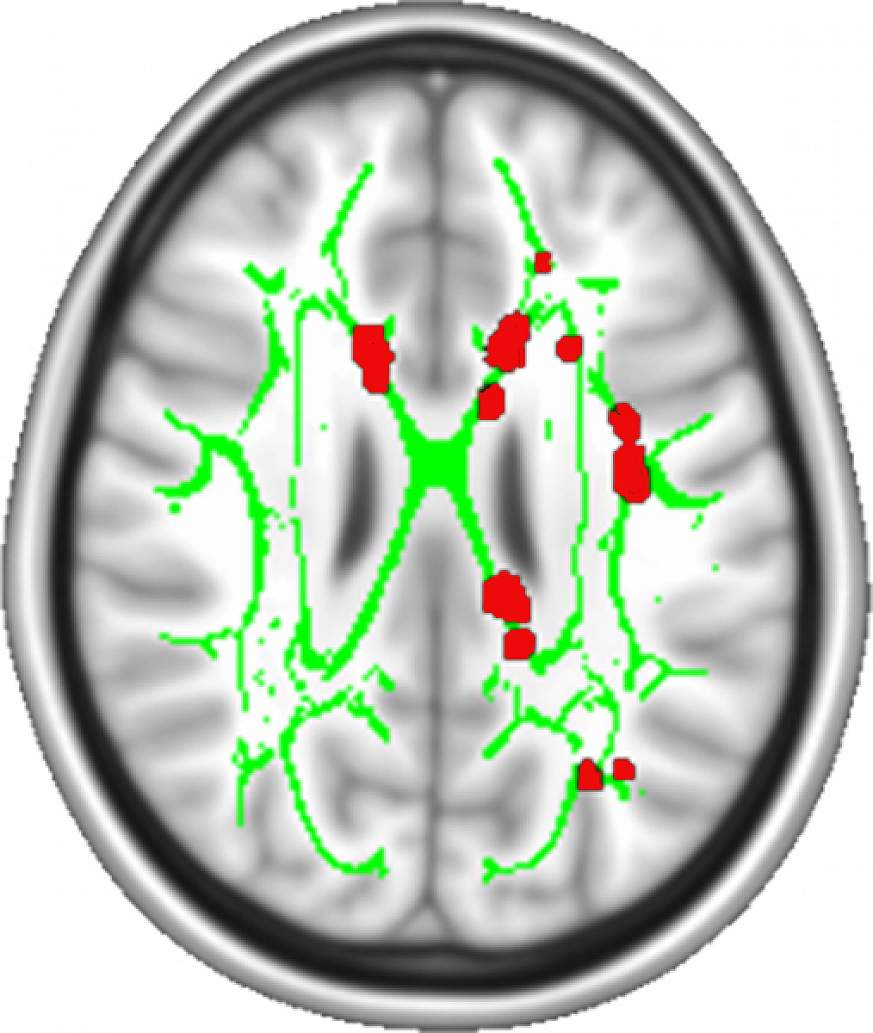 Image of a brain scan