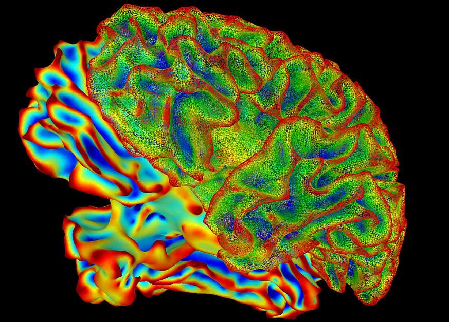 Imaging of a whole, human brain.