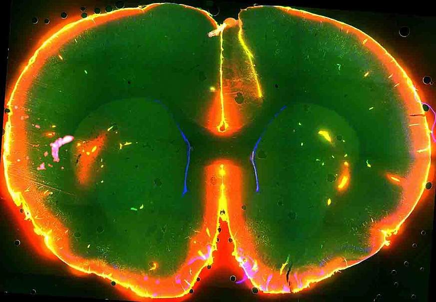 Image of a mouse brain