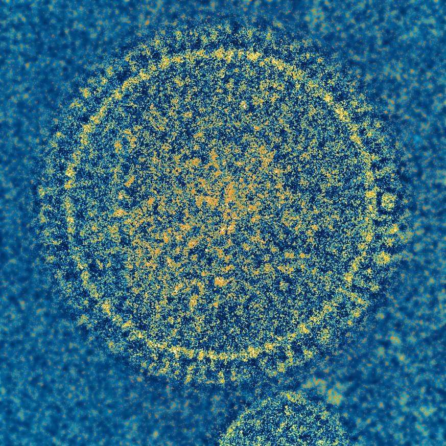 Image of respiratory syncytial virus