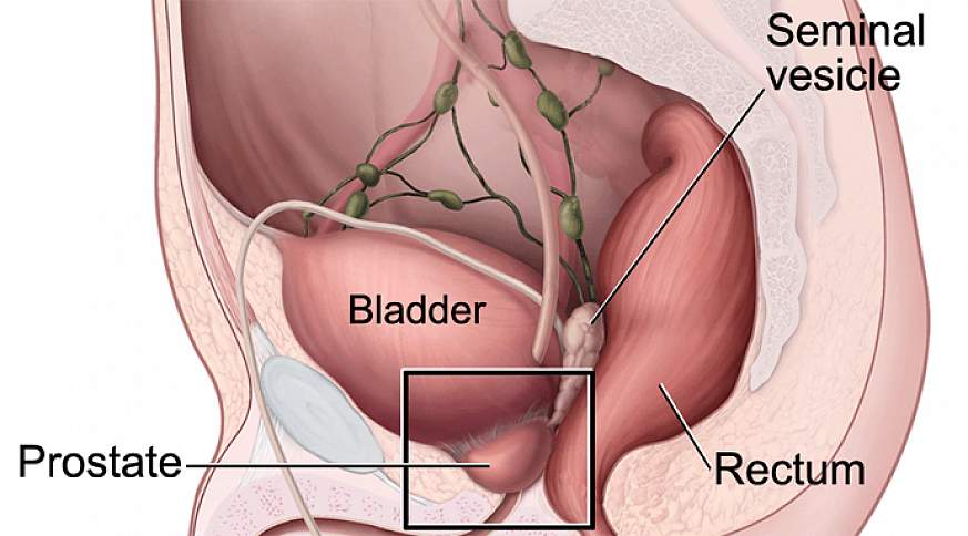 Image of the prostate gland