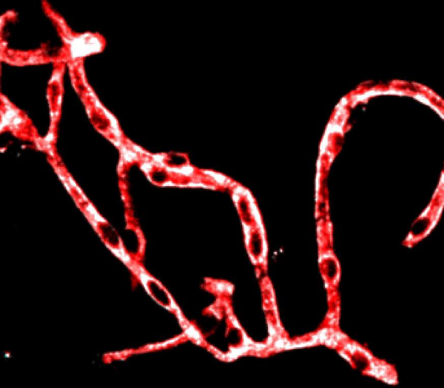 Image of mouse brain blood vessels