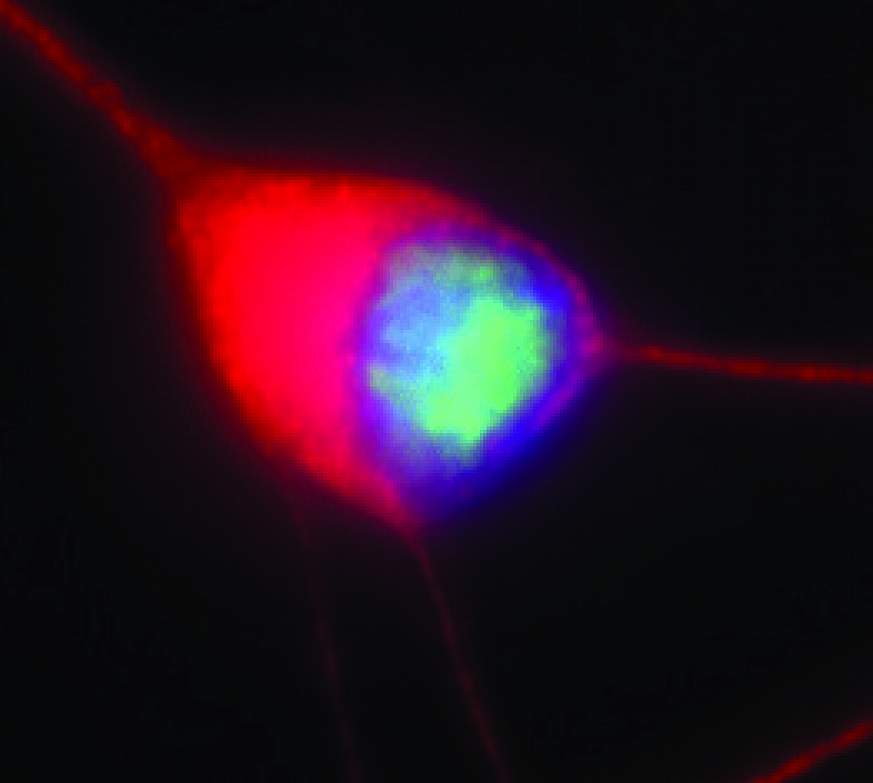 Motor neuron.