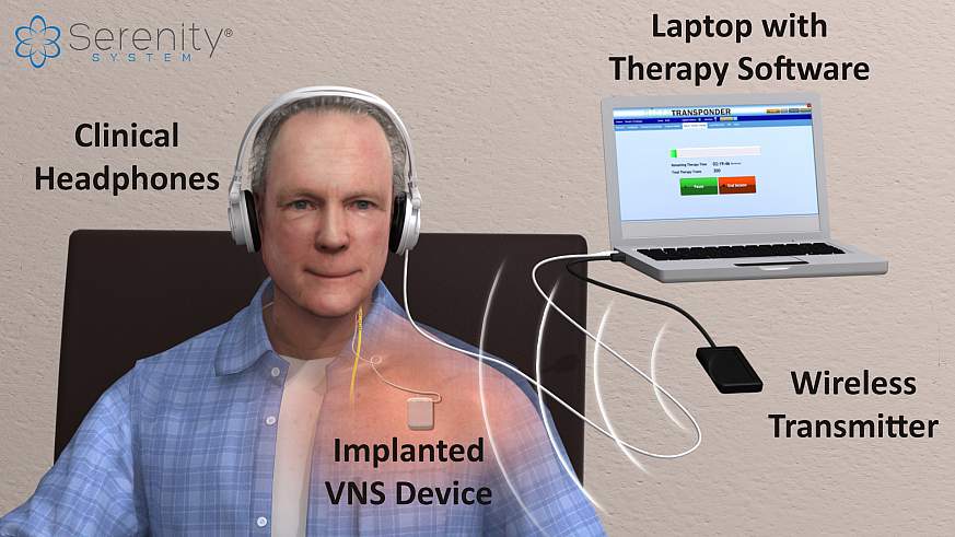 announces recruitment for clinical to test new tinnitus device | Institutes of Health (NIH)