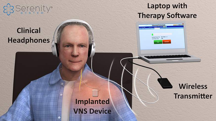 Tinnitus treatment device.