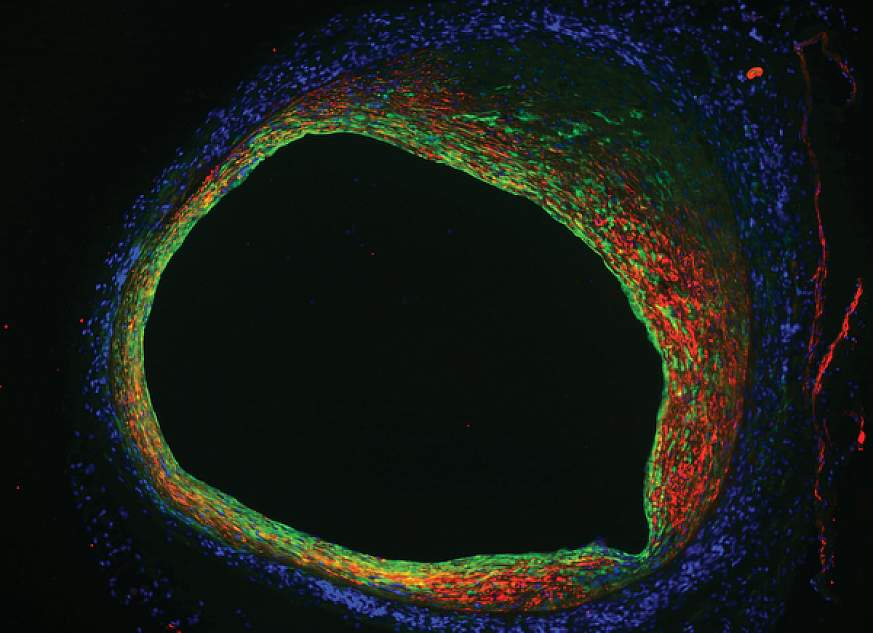 Endothelial cells.