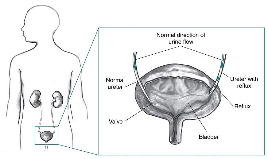 Diagram of the bladder.