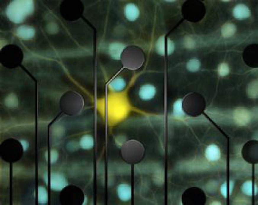 Retinal cells.