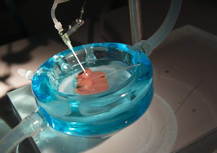 Supercooled rat liver.