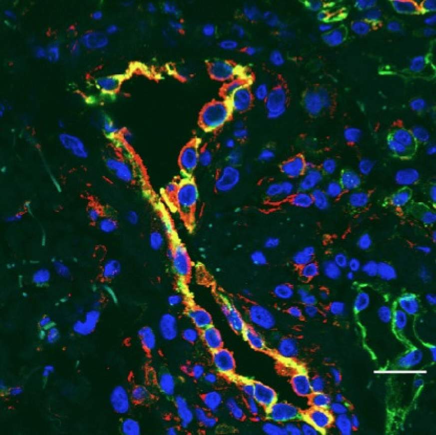 Photo showing inflamed blood vessels