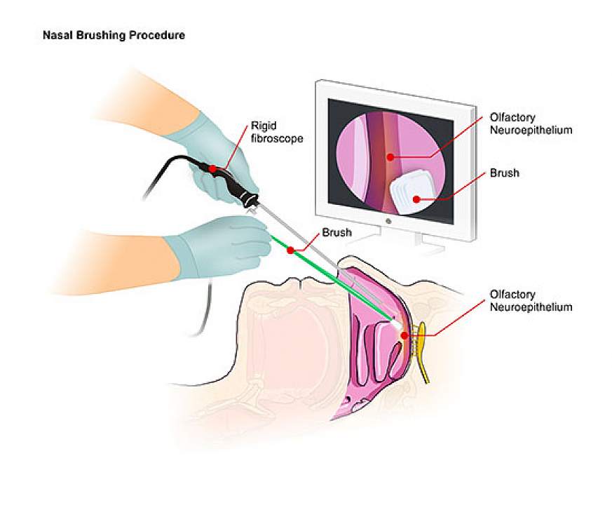 Illustration of nasal brushing technique