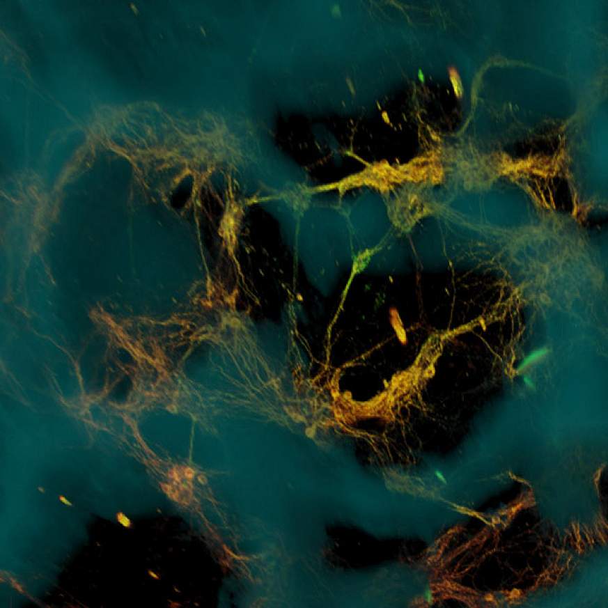 Picture of neurons on scaffold